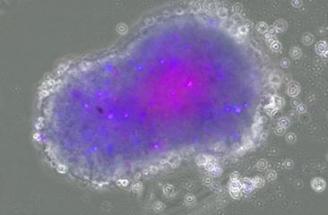 図2：３次元培養したヒト肉腫細胞