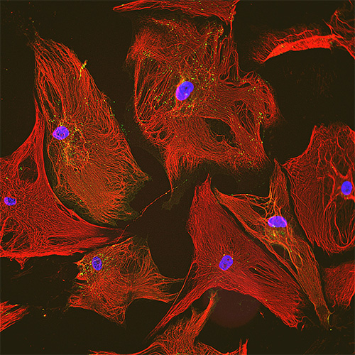 図２：心臓線維芽細胞の顕微鏡写真