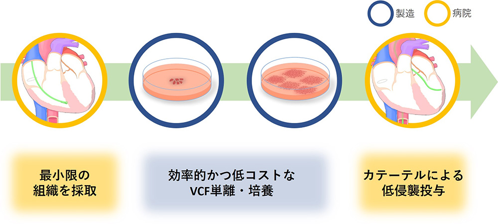 図３：VCFを用いた治療のフロー