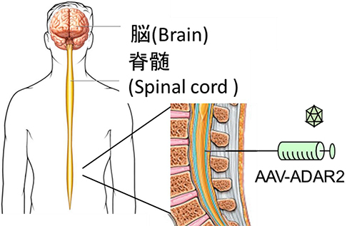 図１：筋萎縮性側索硬化症（ALS）の遺伝子治療